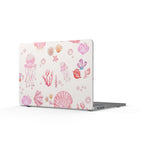 Shell Sick | MacBook Case